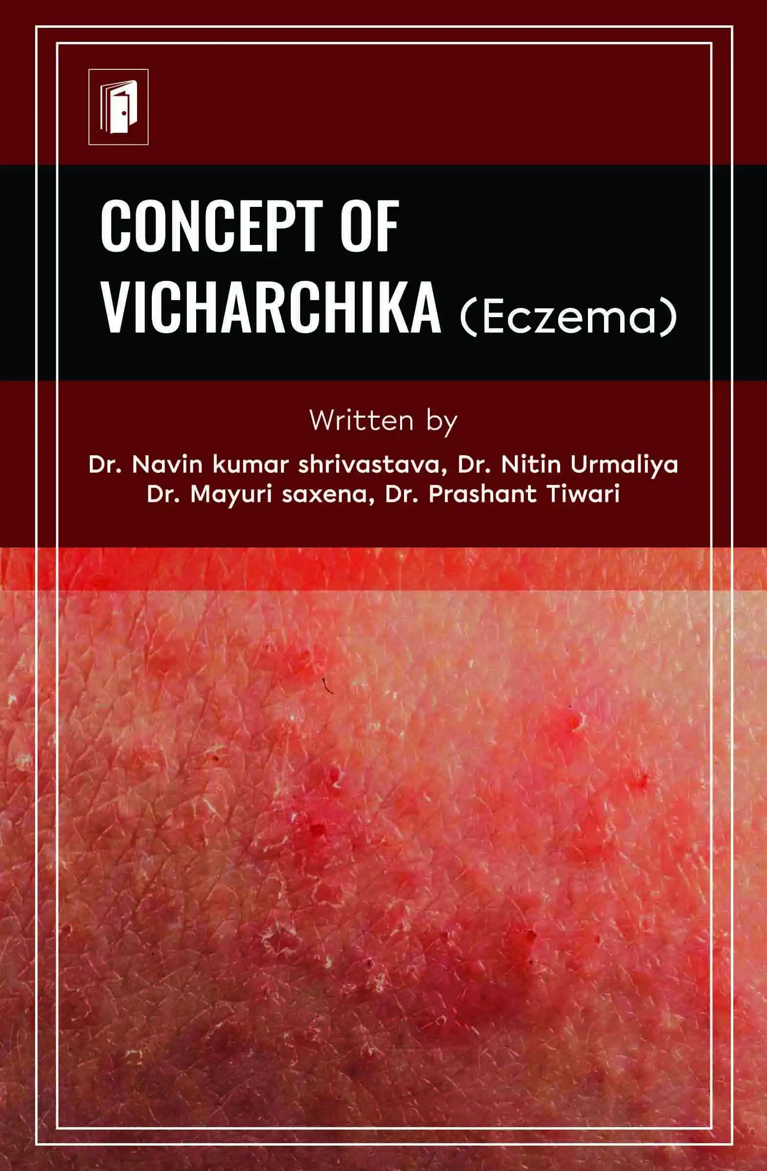 Concept Of Vicharchika Eczema